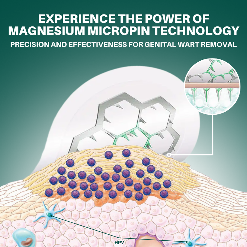 ODALIT™ Magnesium MicroPin HPV Genital Wart Removal Patch | Pain-Free, Clinically Proven Solution