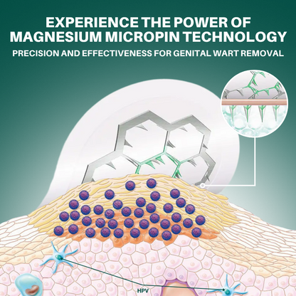 ODALIT™ Magnesium MicroPin HPV Genital Wart Removal Patch | Pain-Free, Clinically Proven Solution