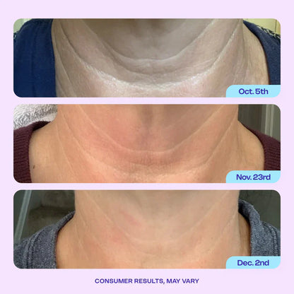 Advanced Firming Neck Cream – Visibly Lifts & Tightens "Turkey