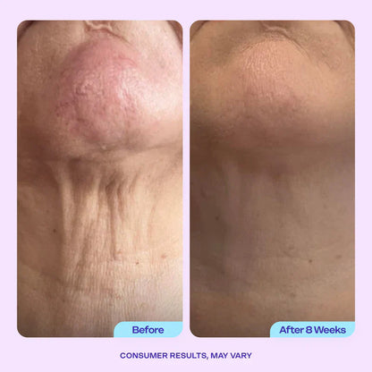 Advanced Firming Neck Cream – Visibly Lifts & Tightens "Turkey